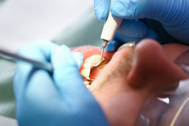 Best Orthodontic Emergency Dentist in Menard, TX