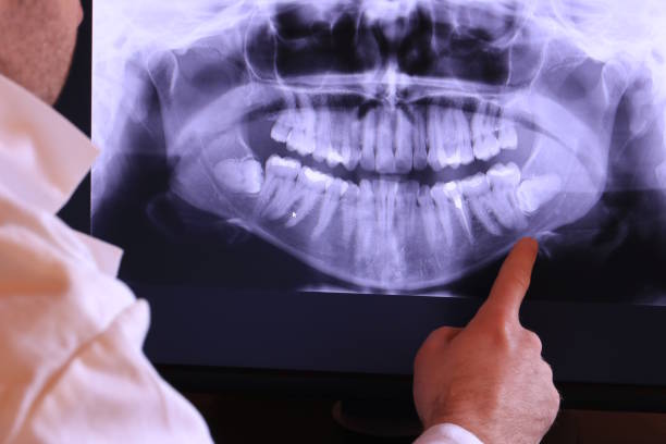 Best Broken or Cracked Tooth Emergency Dentist in Menard, TX