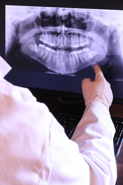 Best Emergency Dentist for Knocked-Out Tooth in Menard, TX