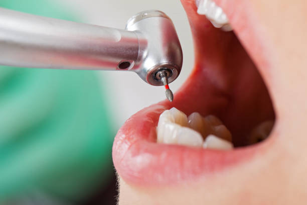 Best Weekend Emergency Dentist in Menard, TX